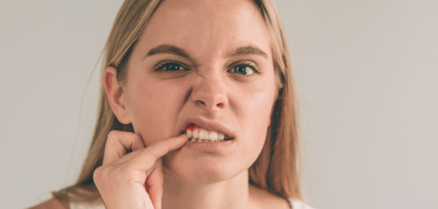 objawy zapalenia dziasel