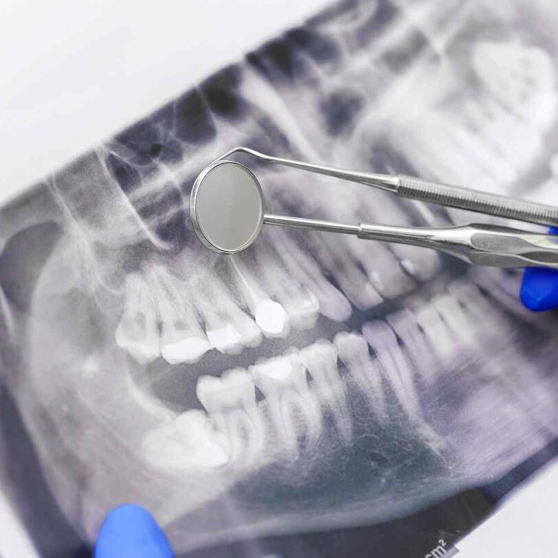 tomografia-cbct-lodz