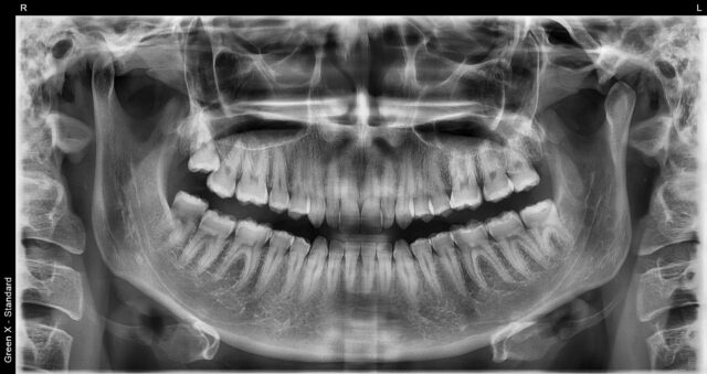 rtg cbct łódź