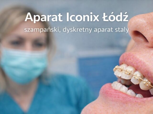 Aparat Iconix  Łódź (szampański)- estetyczny aparat stały | Pro EndoDentica